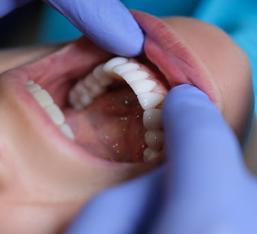 فحص ومعاينة الأسنان - عيادة طب الاسنان دكتور وسام علي 