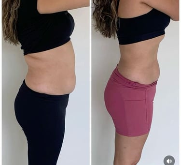 Foto mostrando redução de peso com prática de exercícios e nutrição balanceada.