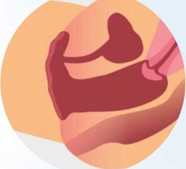 фото Схема збільшеної піхви