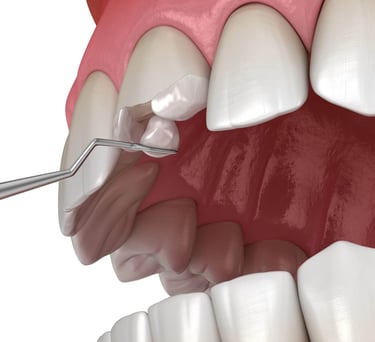 dentist in baner