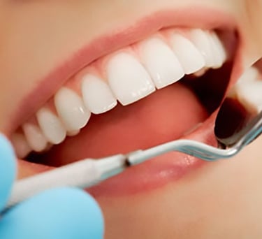 general dentistry in baner 
