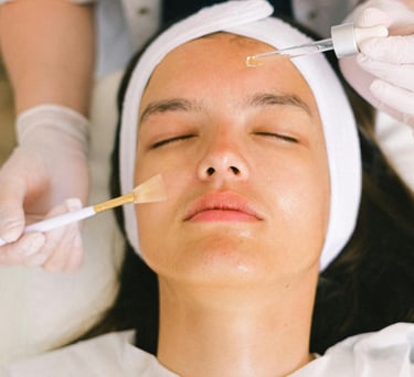 Chemical Peel and Platelet-Rich Plasma