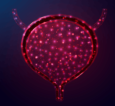 Mesane kanserini gösteren bir çizim.