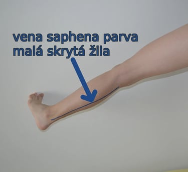 a person with a blue arrow pointing to the left side of the arm