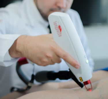Cirurgião Vascular Lucas Vinicius Brun realizando procedimento de Laser Transdermico para varizes