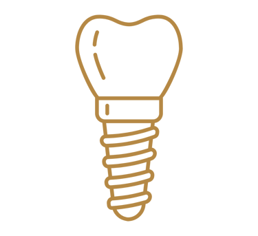 Desenho de um implante dentário em São Mateus do Sul