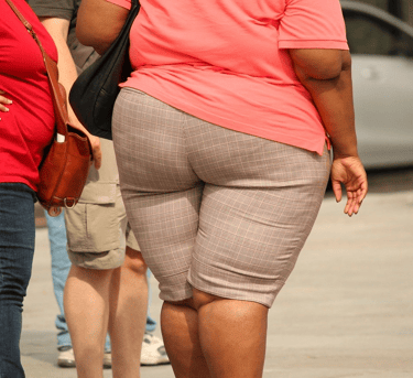 Obesity example