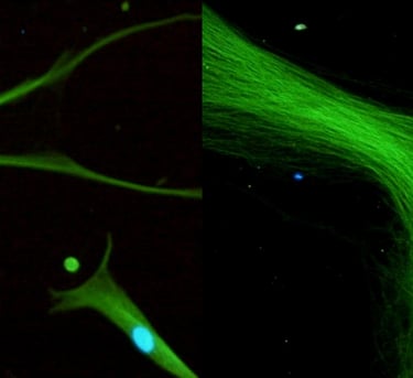 Stem Cell Research