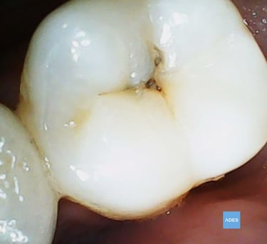 empaste dental