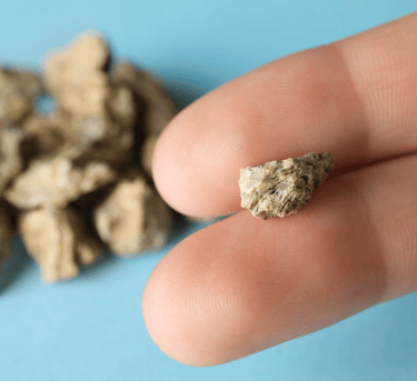 Bir kişi parmaklarının arasında böbrek taşlarını tutup, kameraya gösteriyor. Yakın plan