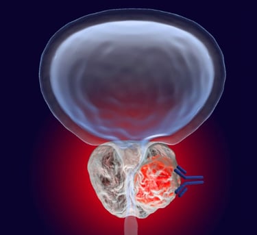 BPH gösteren bir çizim