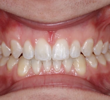 pictures of teeth