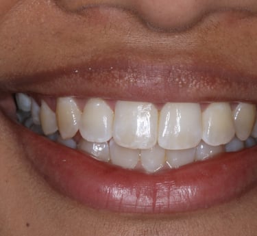 pictures of teeth