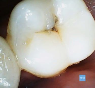 empaste dental