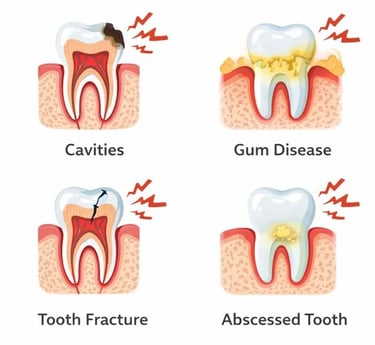 Illustration showing common causes of tooth pain