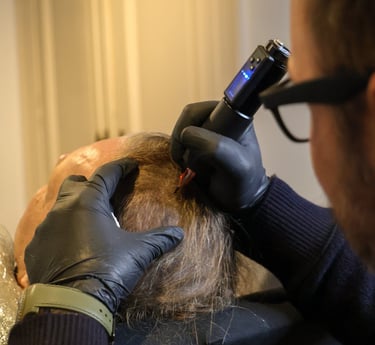 Séance de densification capillaire grâce à la micropigmentation