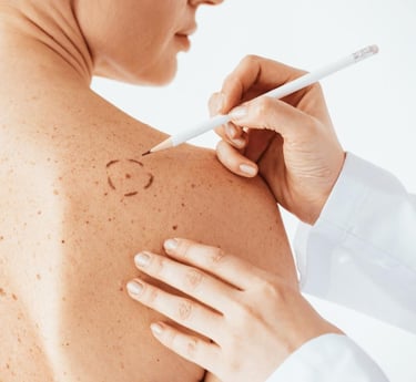 Skin Cancer Surgery