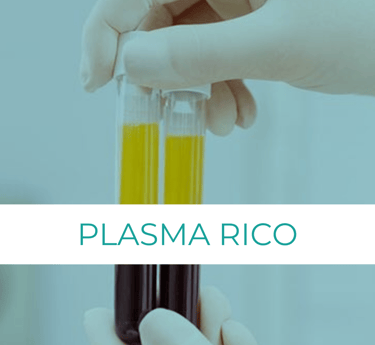 prp plasma rico en plaquetsa