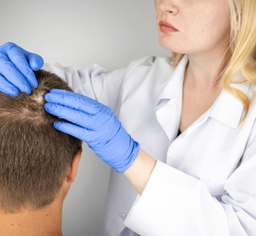 Alopecia