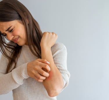 Eczema