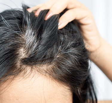 Gray Hair