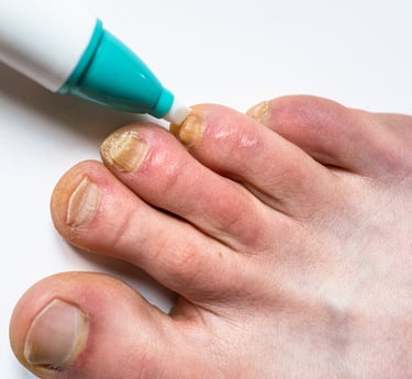 Nail Fungus