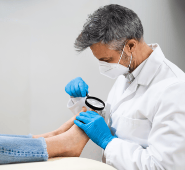 Ingrown Hair