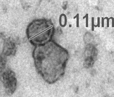 Extracellular Vesicles