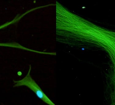 Stem Cell Research