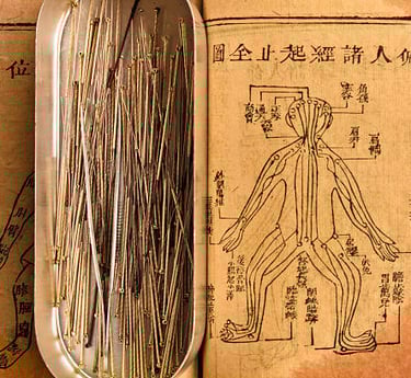 acupuncteur médecine chinoise crolles ingrid lailaut