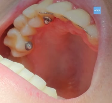 Servicios de odontología en Badajoz