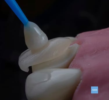 estética dental