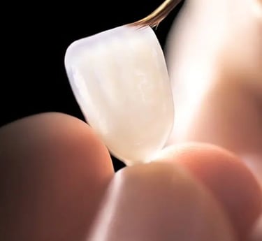 Dentista aplicando lentes de contato dental em paciente, utilizando tecnologia moderna em clínica de Taguatinga.