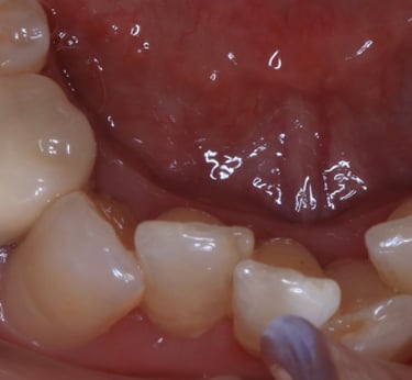 pictures of teeth