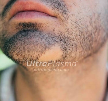 _ultra_plasma_ultra_plazma_ultra-plasma_ultra-plazma