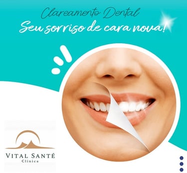 clareamento dentário dental dentista recreio