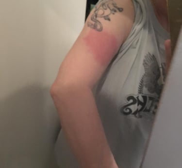 my mums arm