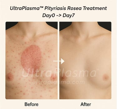 ultra_plasma_ultra_plazma_ultra-plasma_ultra-plazma