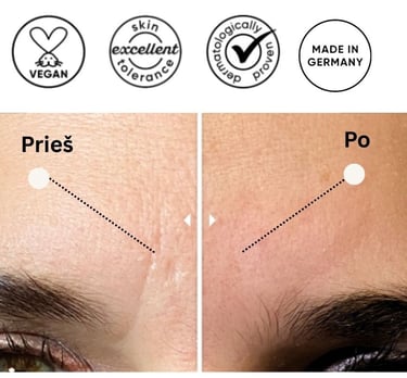 Pleistro nuo raukšlių poveikis odai. Kaip išlygintos raukšlės. 