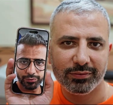 client before and after pic 