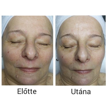 Neuro Cannabis kezelés Veszprém