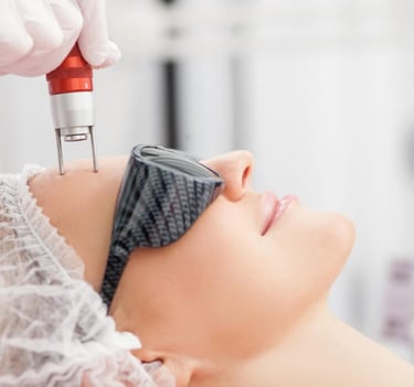 woman receiving laser skin resurfacing treatment