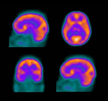 Nuc Med & PET Physics Survey