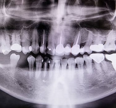 Dental & Vet X-ray Annual Physics Test