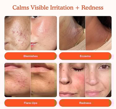 Minimalist graphic showing the spray’s key benefits including redness reduction, skin barrier suppor