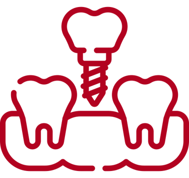 a dental implanting toothbrushes and a toothbrush