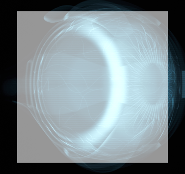 Flashes & Floaters a picture of an x-rayed eye