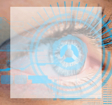 Keratoconus - a woman's eye with a futuristic eye