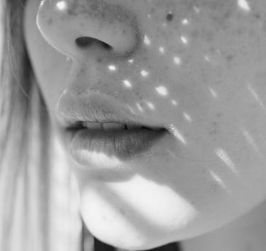 tratamientos capilares murcia microneedling hilos tensores faciales láser luz pulsada LED fototerapi