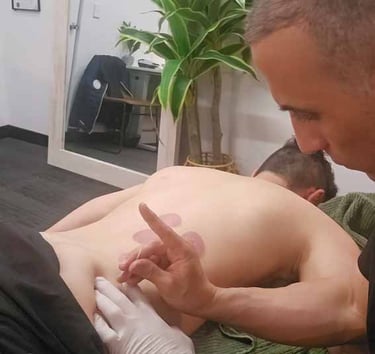Action shot showing male massage therapist inserting a dry needle into someone